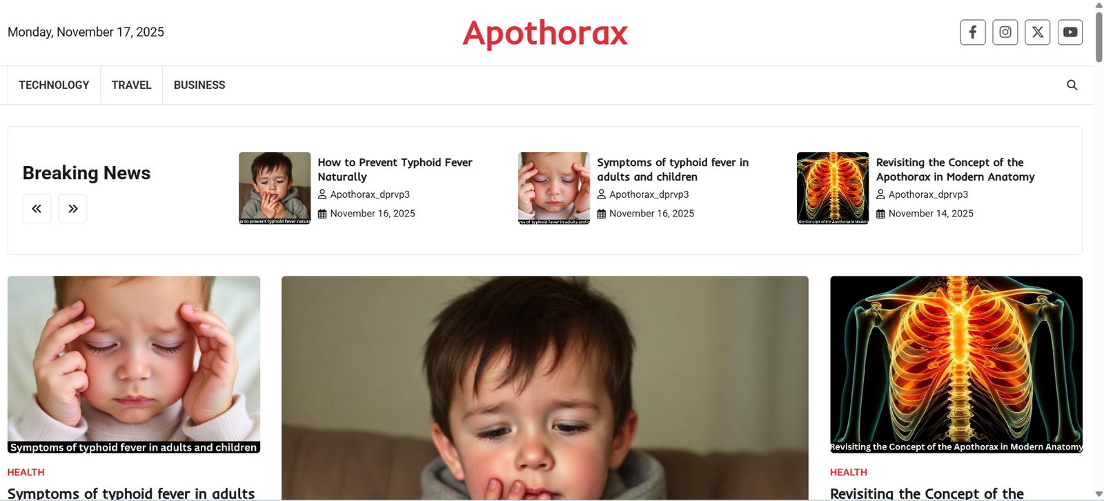 Understanding “Apothorax”: Definition, Location & Key Organs